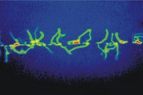 Ein Abbildung einer Thermographie.